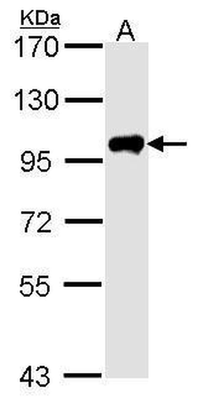 Calpain 3 Antibody in Western Blot (WB)