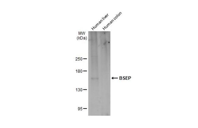 ABCB11 Antibody in Western Blot (WB)