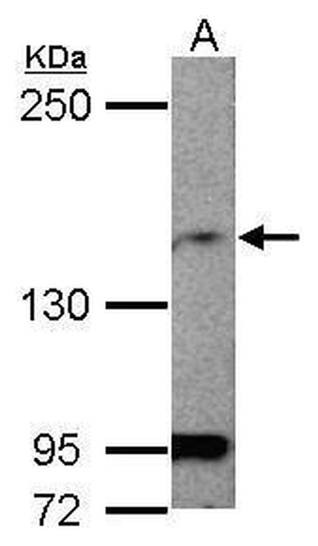 MAGI1 Antibody in Western Blot (WB)