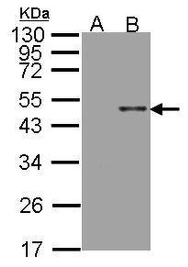 Arylsulfatase B Antibody in Western Blot (WB)