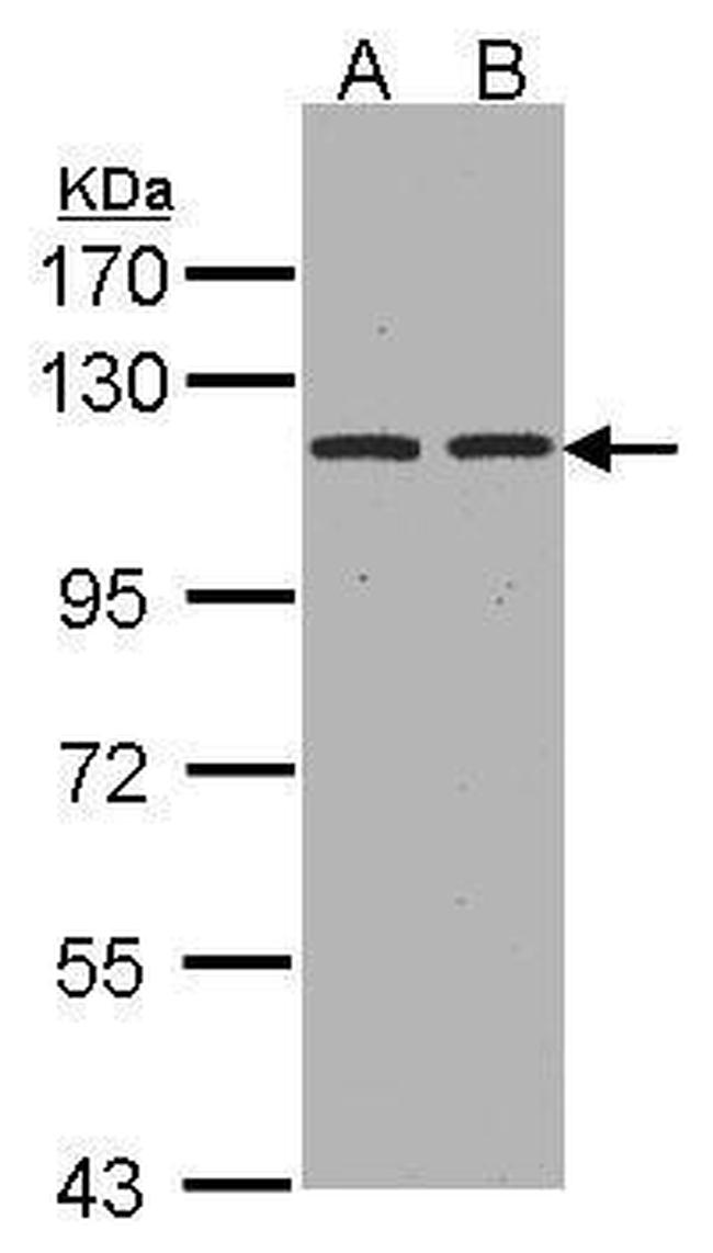CD249 Antibody in Western Blot (WB)