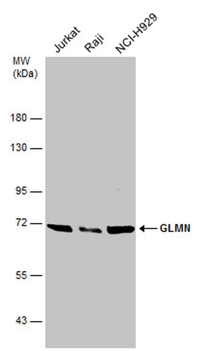 GLMN Antibody in Western Blot (WB)
