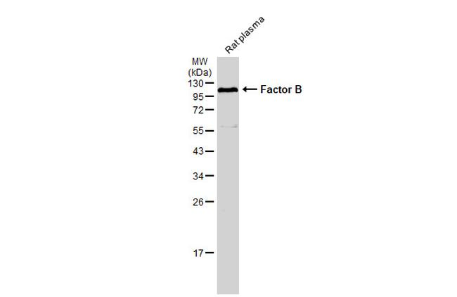 Complement Factor B Antibody in Western Blot (WB)