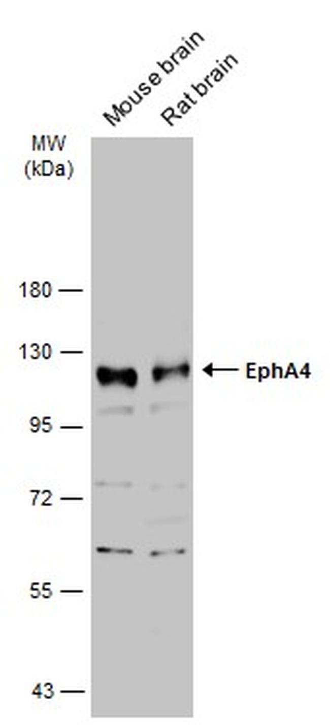 EphA4 Antibody in Western Blot (WB)