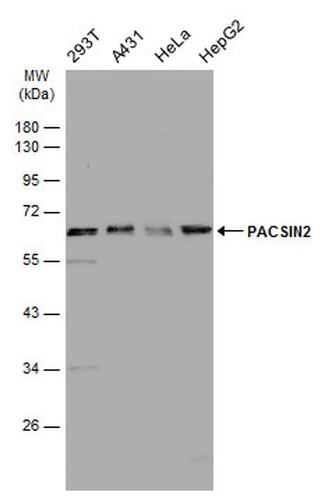 PACSIN2 Antibody in Western Blot (WB)