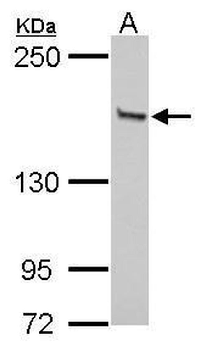 GLI3 Antibody in Western Blot (WB)