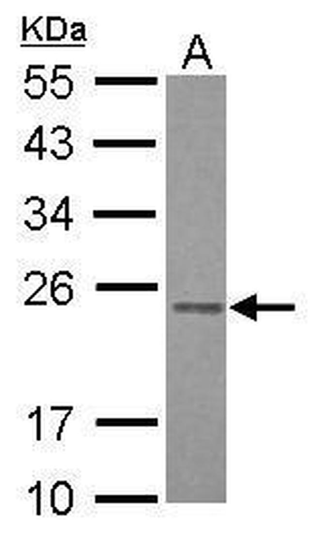 RAB3B Antibody in Western Blot (WB)