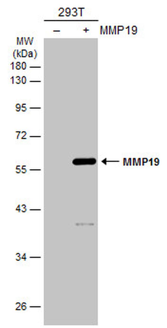 MMP19 Antibody in Western Blot (WB)