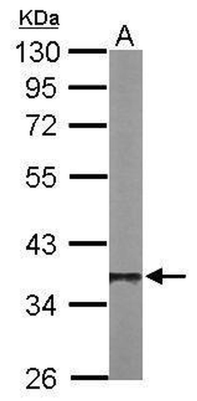 PP1 beta Antibody in Western Blot (WB)