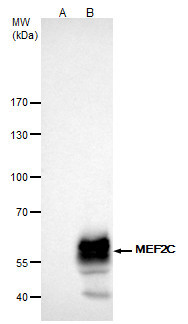 MEF2C Antibody in Immunoprecipitation (IP)