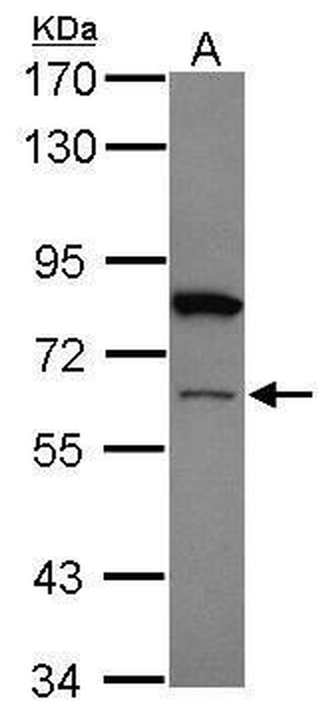 ZNF449 Antibody in Western Blot (WB)