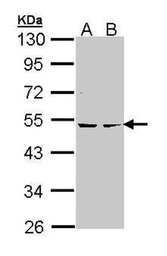 PRKAR2B Antibody in Western Blot (WB)