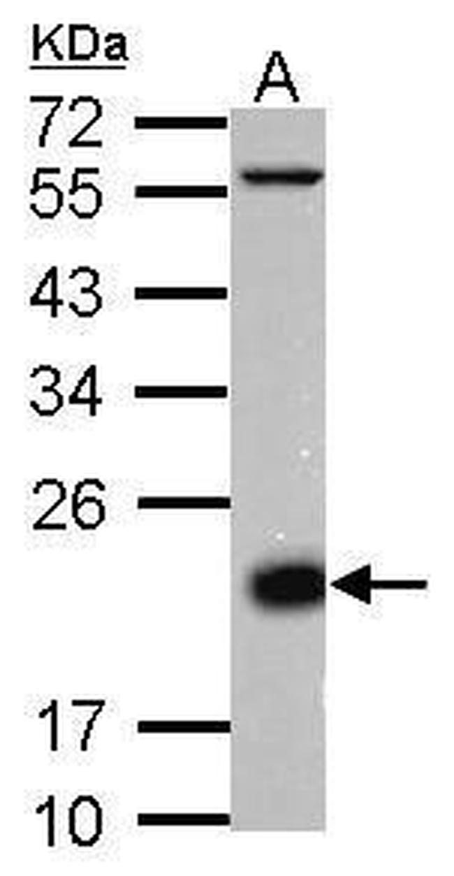 CD3d Antibody in Western Blot (WB)
