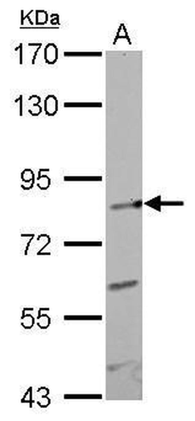 GIT1 Antibody in Western Blot (WB)