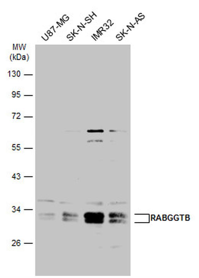 RABGGTB Antibody in Western Blot (WB)