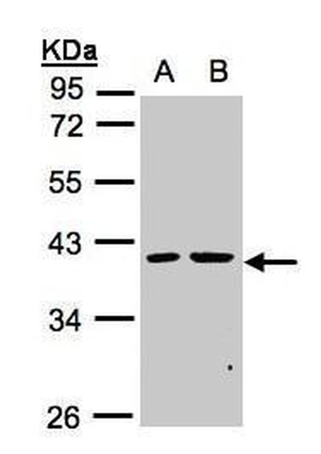 PSKH2 Antibody in Western Blot (WB)