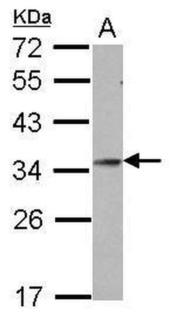 GSC Antibody in Western Blot (WB)