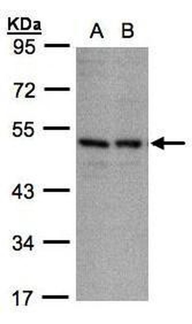 KIR3DL1 Antibody in Western Blot (WB)