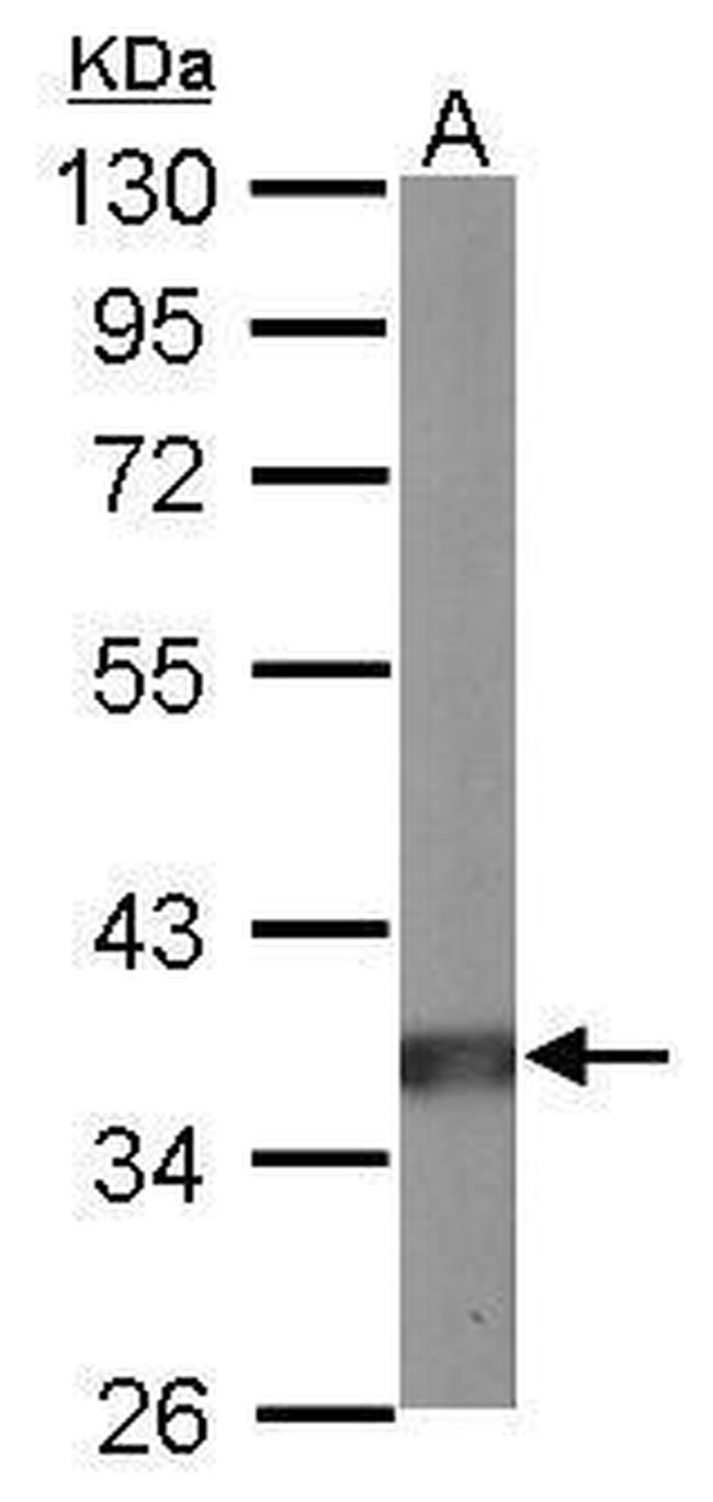 PP2A alpha Antibody in Western Blot (WB)