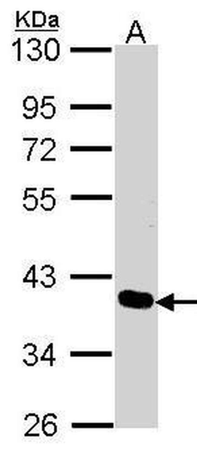 PDLIM4 Antibody in Western Blot (WB)