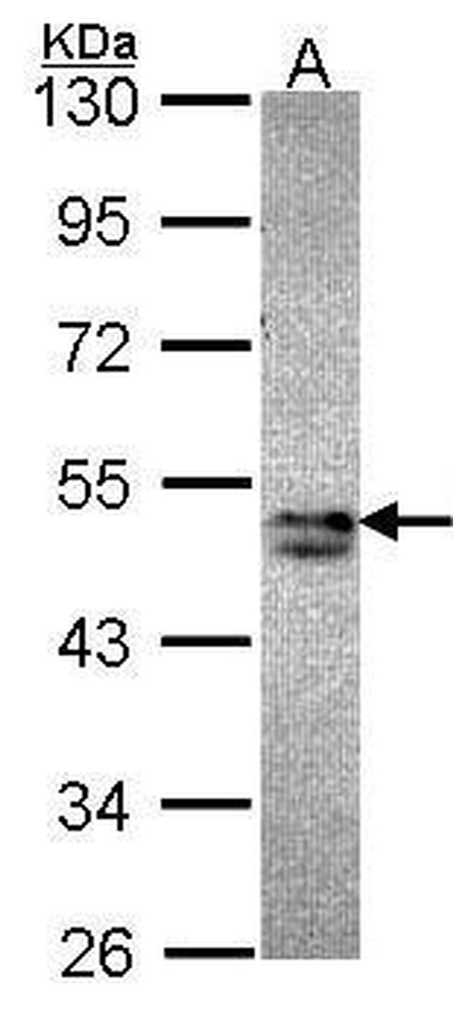 SNX15 Antibody in Western Blot (WB)