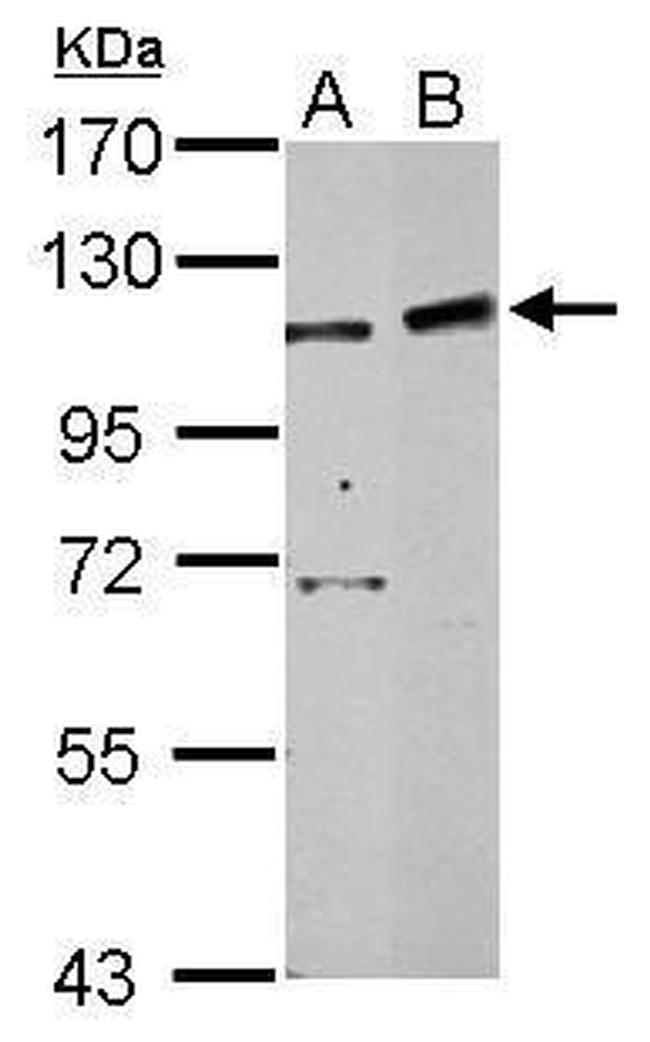 PHF16 Antibody in Western Blot (WB)