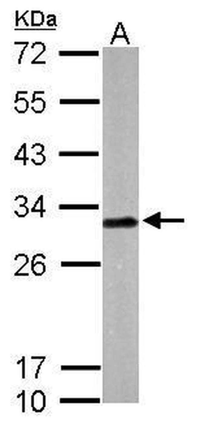 Latexin Antibody in Western Blot (WB)