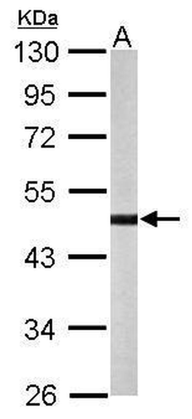 STK32B Antibody in Western Blot (WB)