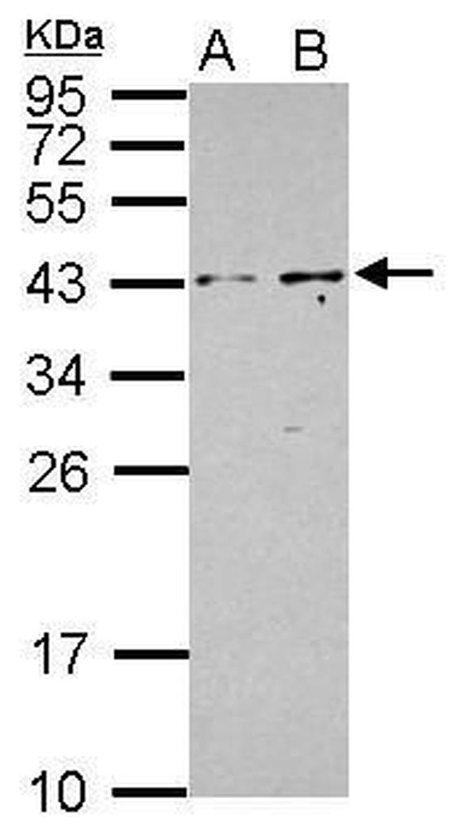 PIP5KL1 Antibody in Western Blot (WB)