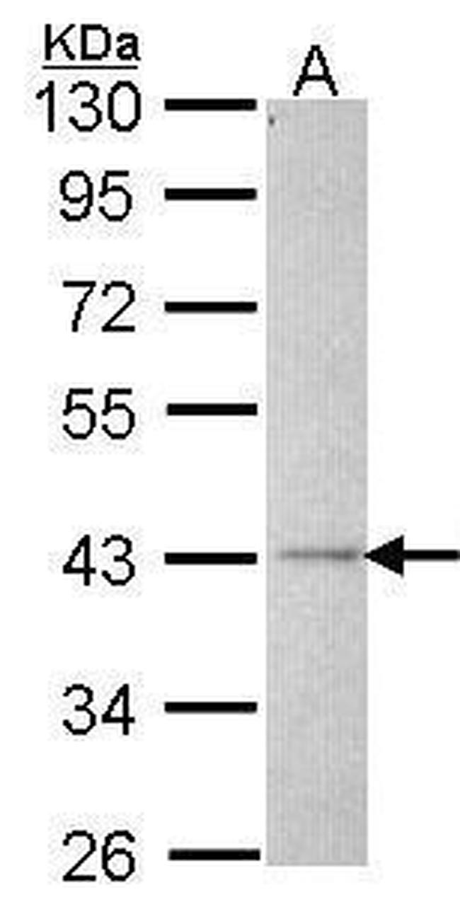 ALS2CR2 Antibody in Western Blot (WB)