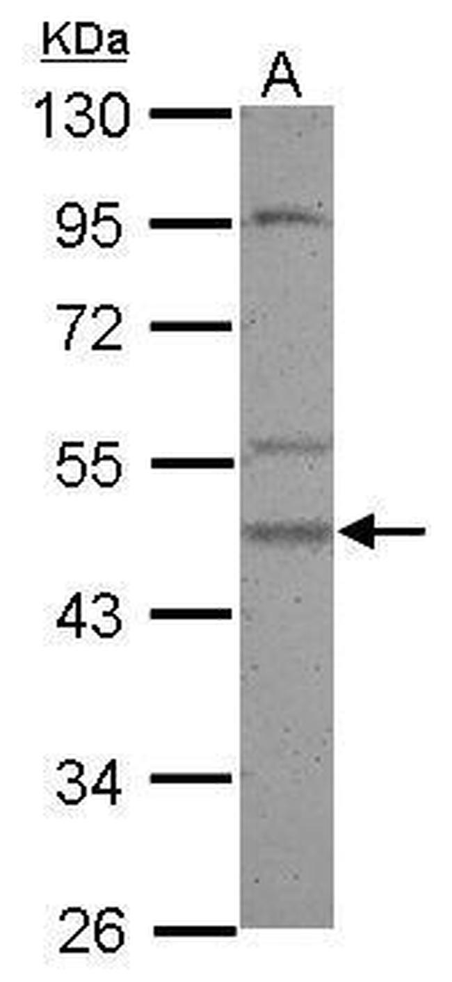 CK1 gamma-2 Antibody in Western Blot (WB)