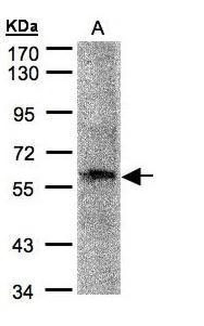 PRAM1 Antibody in Western Blot (WB)