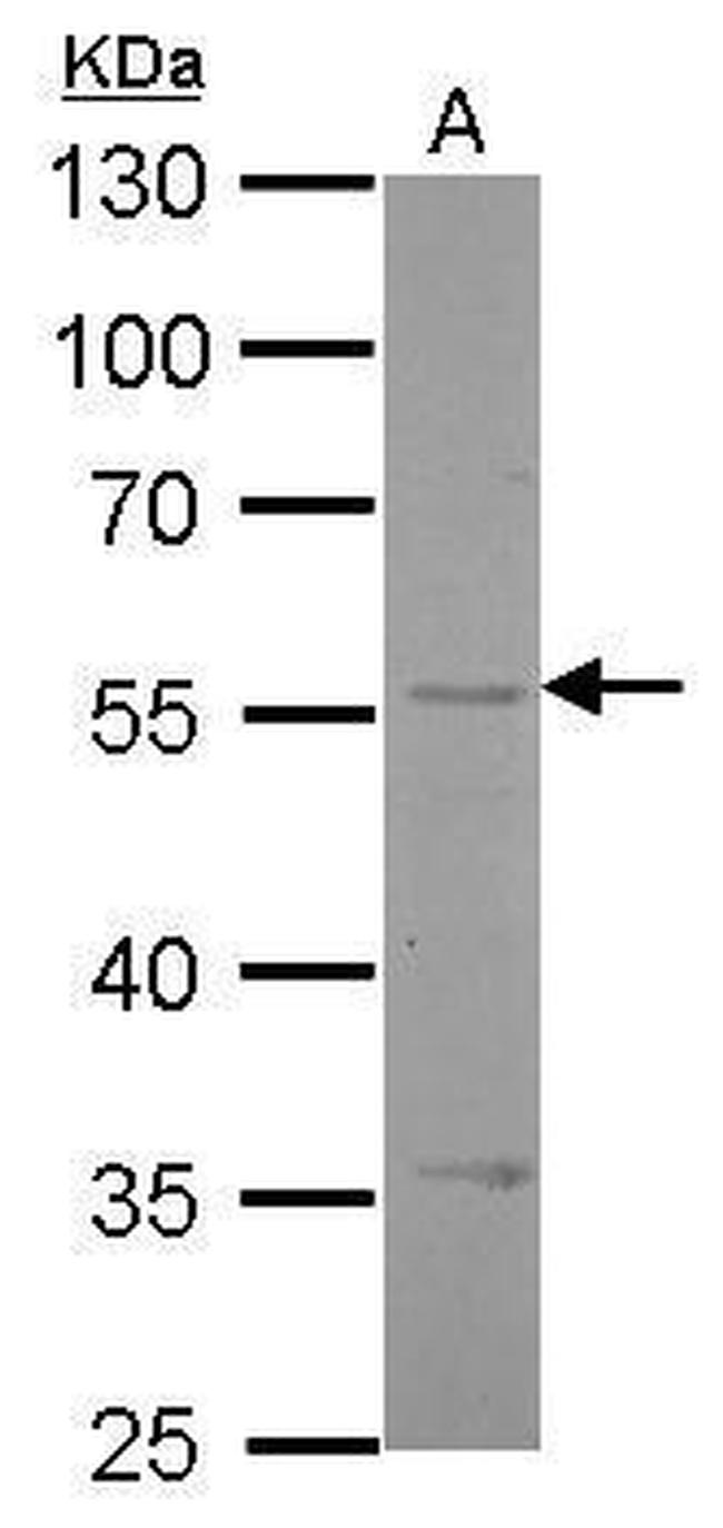 Endothelin B Receptor Antibody in Western Blot (WB)