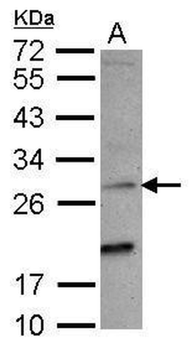 NKG2C Antibody in Western Blot (WB)