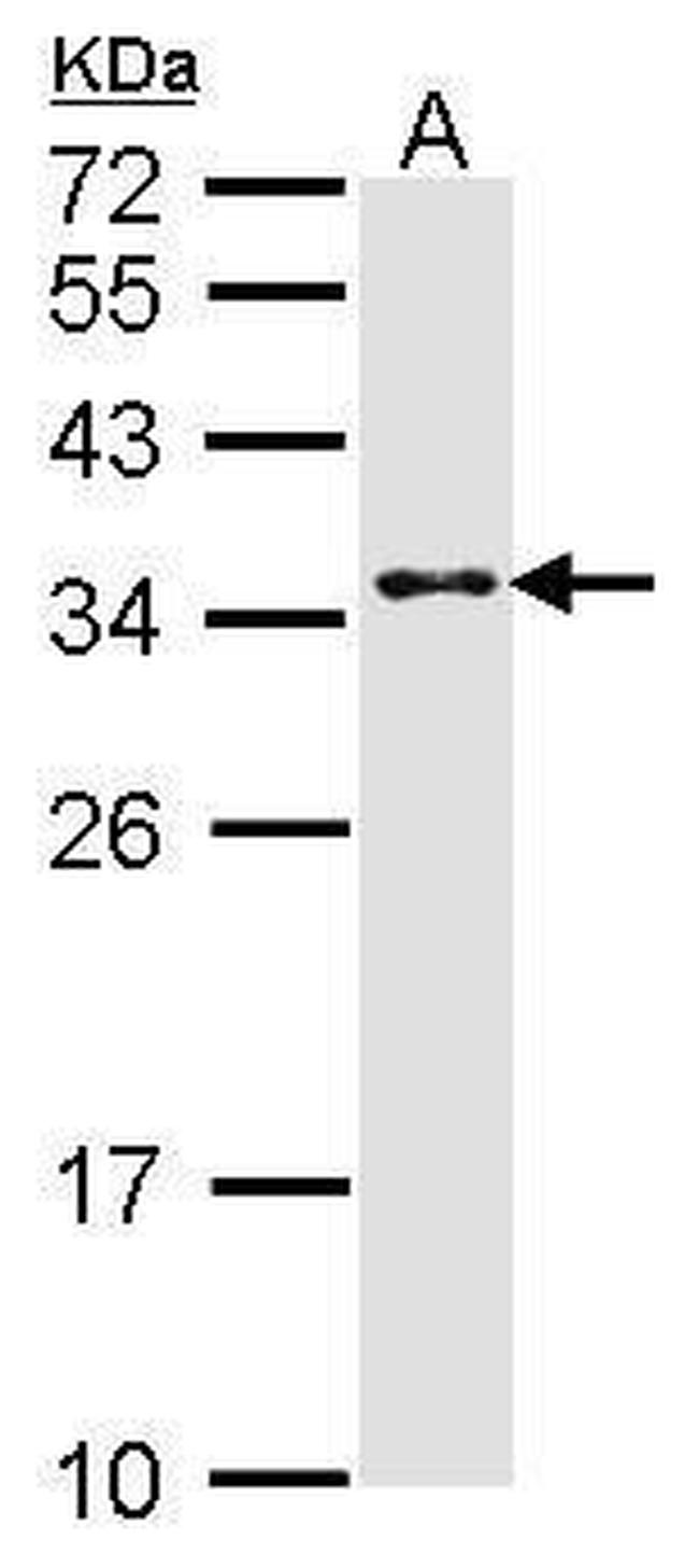 CRSP9 Antibody in Western Blot (WB)