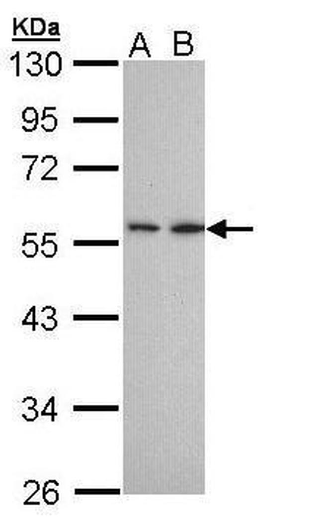 DPP2 Antibody in Western Blot (WB)
