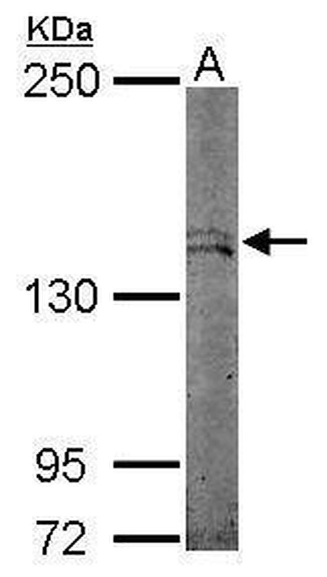 STK36 Antibody in Western Blot (WB)