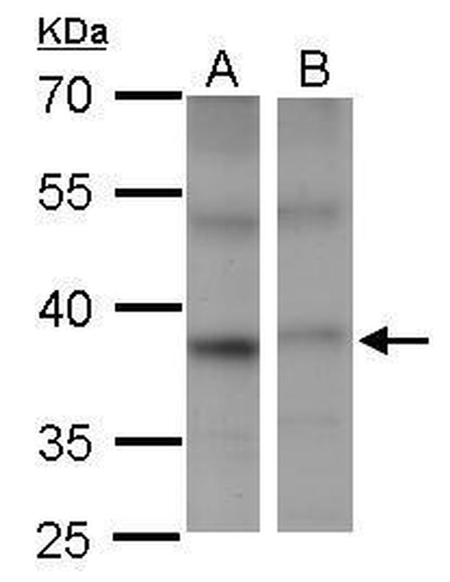 PSTPIP2 Antibody in Western Blot (WB)
