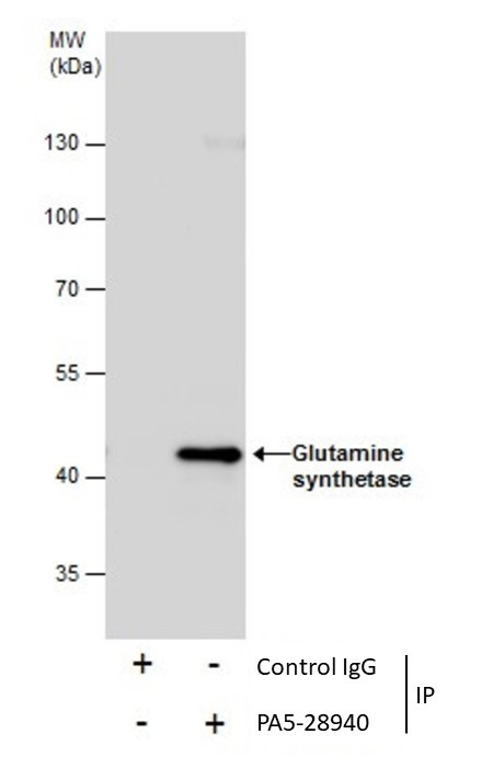 Glutamine Synthetase Antibody in Immunoprecipitation (IP)