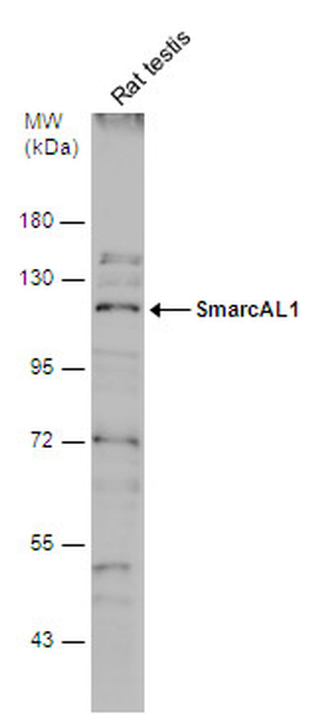 SMARCAL1 Antibody in Western Blot (WB)