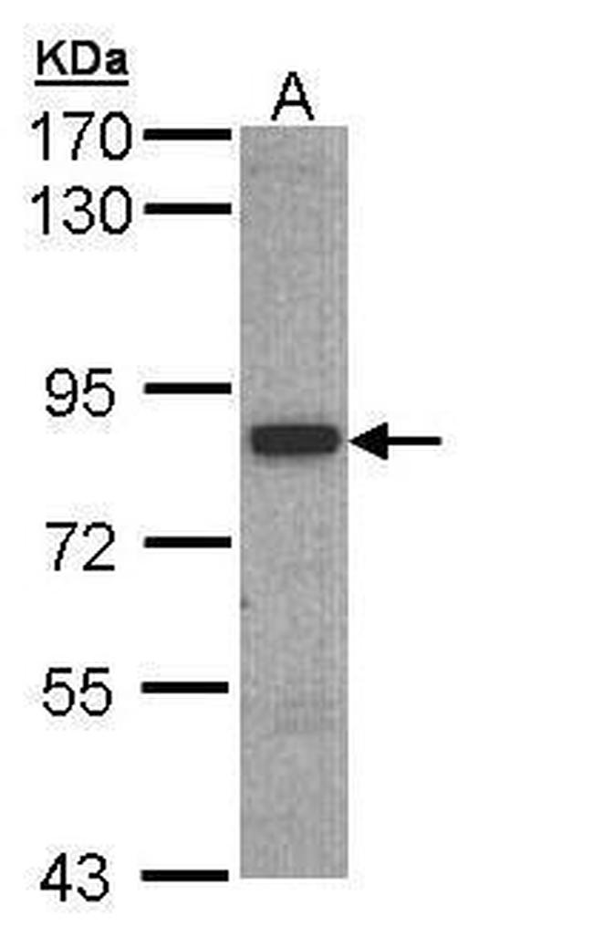 SH3BP2 Antibody in Western Blot (WB)