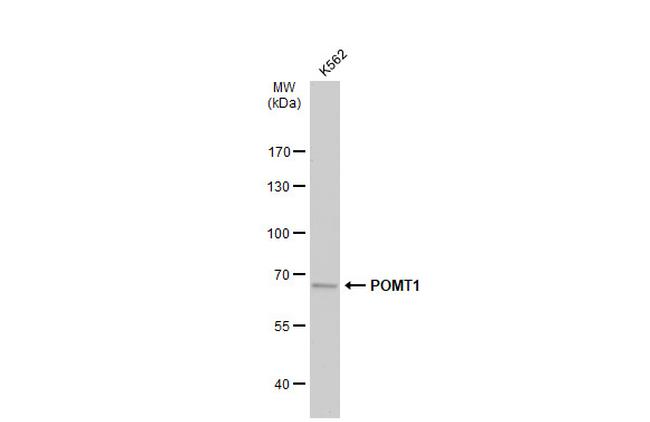 POMT1 Antibody in Western Blot (WB)