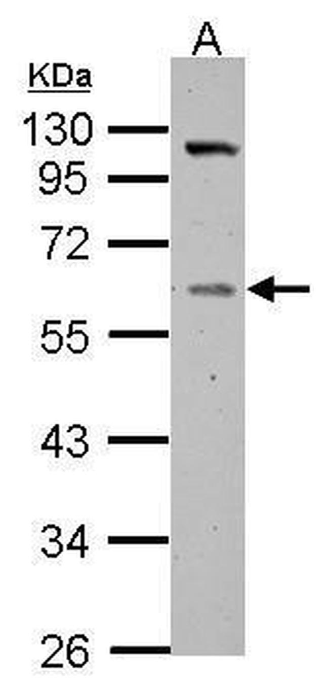 GC Antibody in Western Blot (WB)