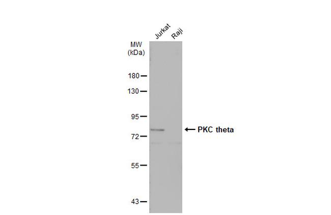 PKC theta Antibody in Western Blot (WB)