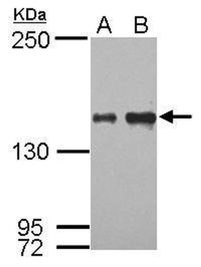 IKAP Antibody in Western Blot (WB)