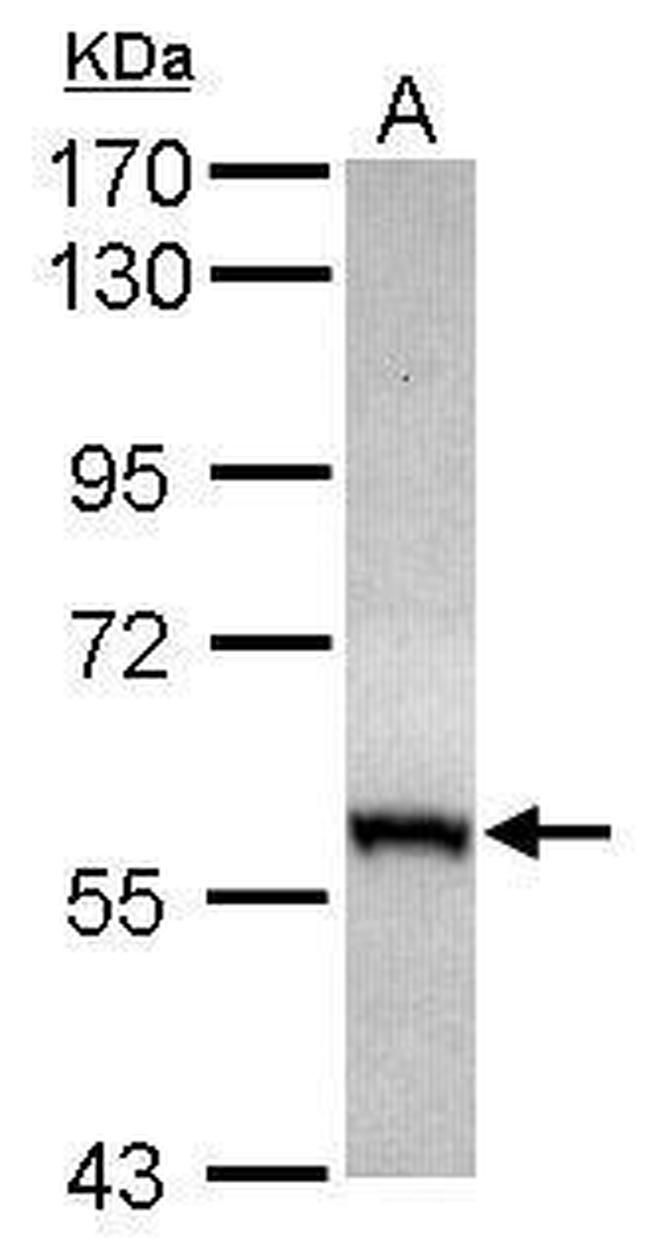 CABC1 Antibody in Western Blot (WB)