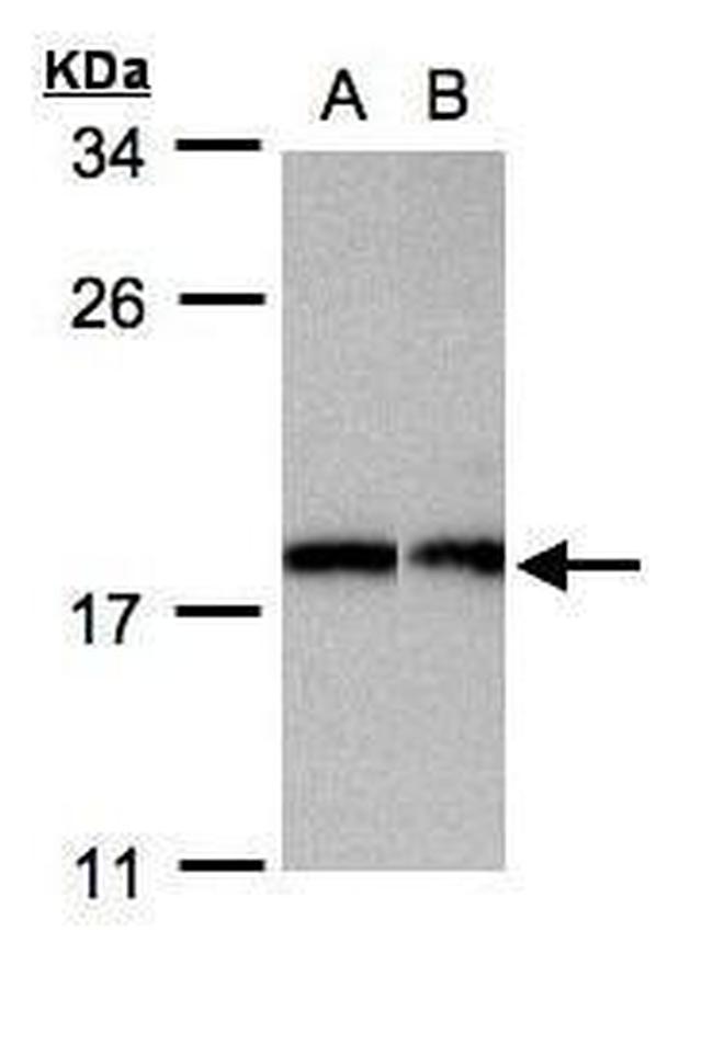 APC11 Antibody in Western Blot (WB)