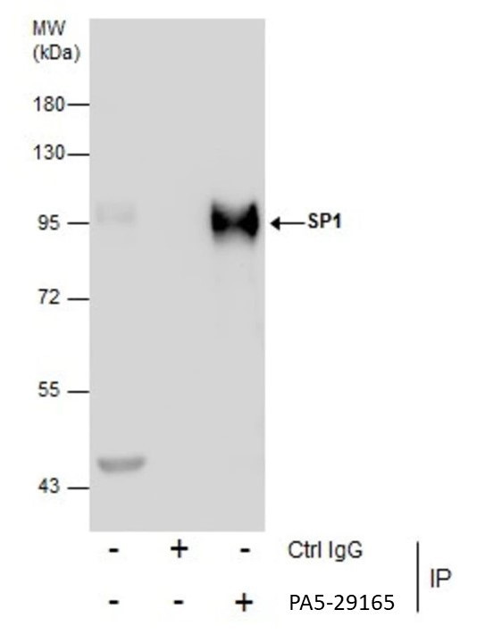 SP1 Antibody in Immunoprecipitation (IP)