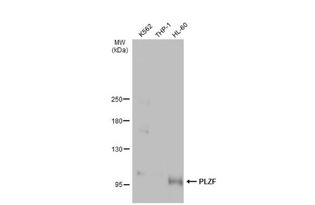 PLZF Antibody in Western Blot (WB)