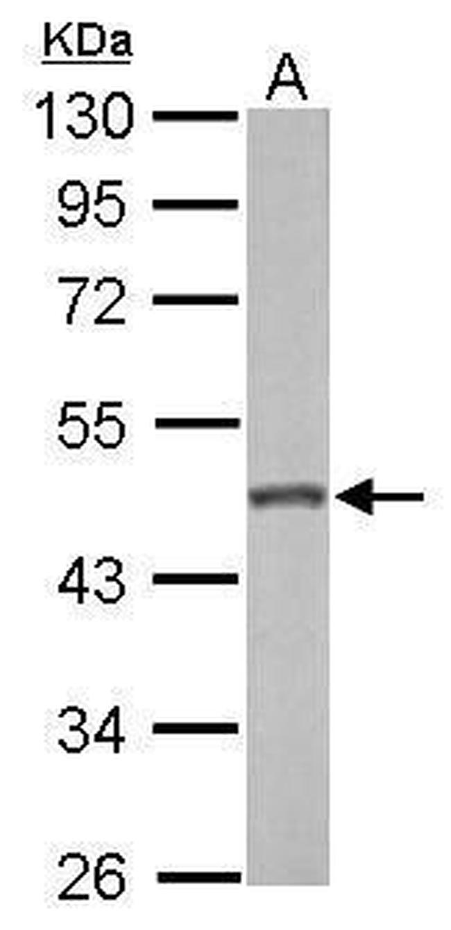 GALK2 Antibody in Western Blot (WB)